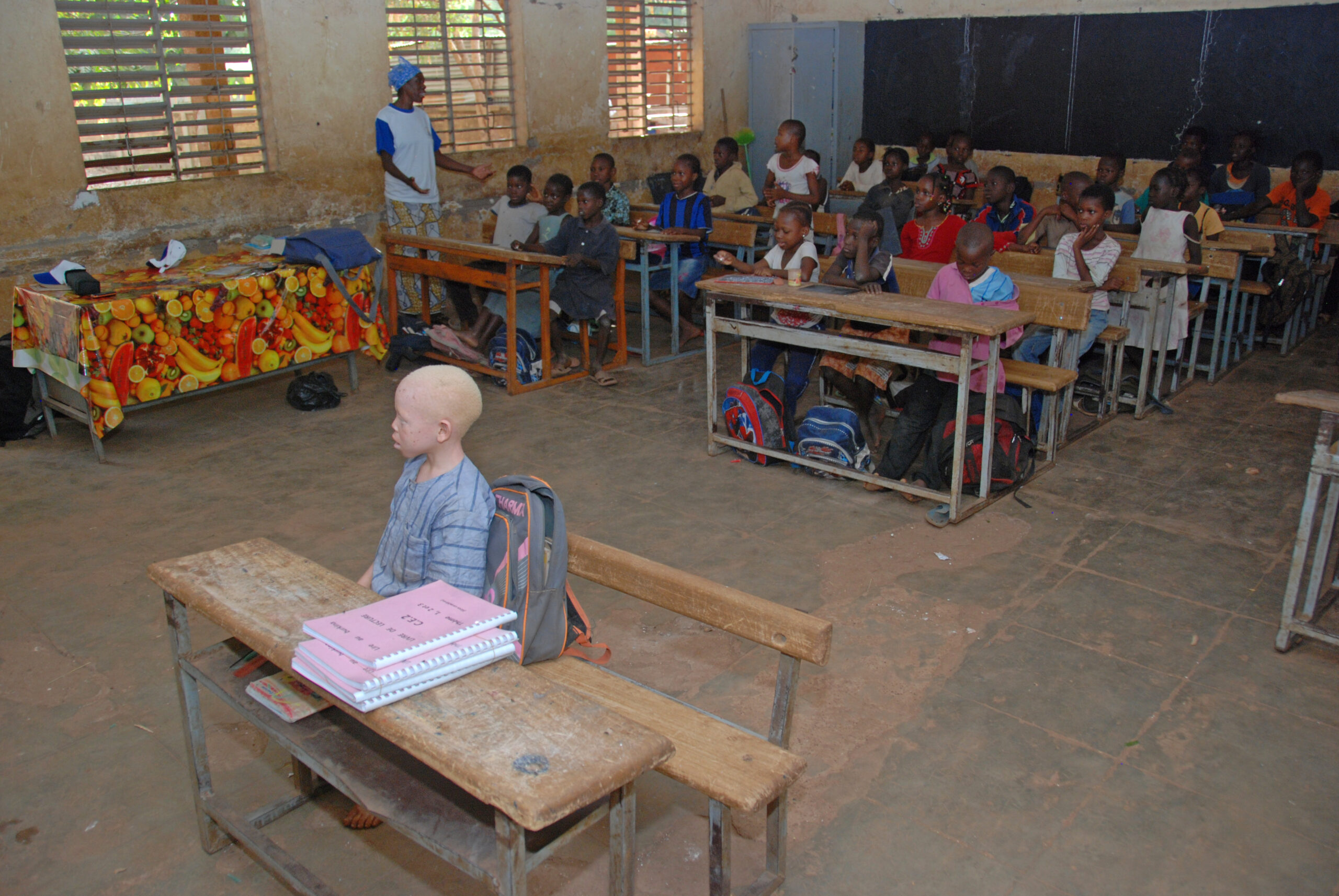 kind met albinisme vooraan in de klas